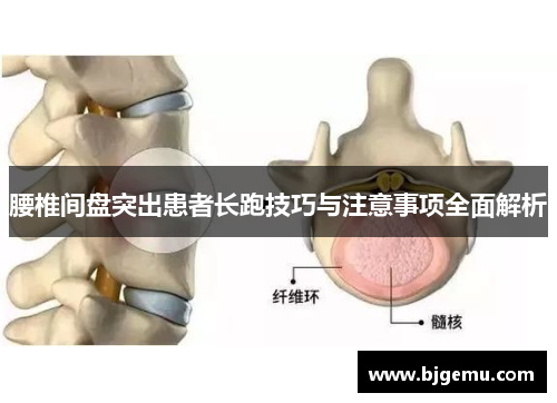 腰椎间盘突出患者长跑技巧与注意事项全面解析